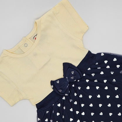 Yellow baby wear