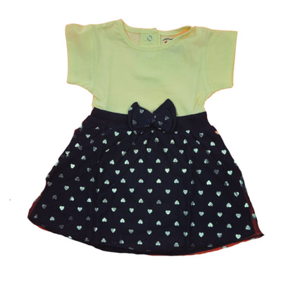 Yellow dress boche firstkiss